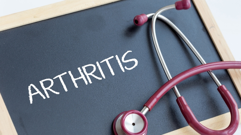 How to Prevent Arthritis - Learn some Useful Lifestyle Changes